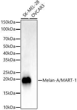 Melan-A/MART-1 Rabbit mAb
