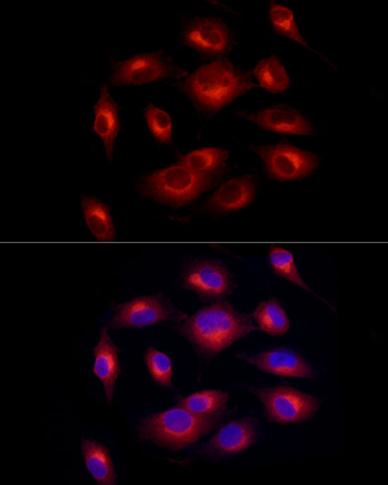 Melan-A/MART-1 Rabbit mAb