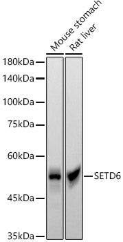 SETD6 Rabbit mAb