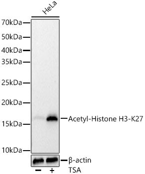 Acetyl-Histone H3-K27 Rabbit mAb