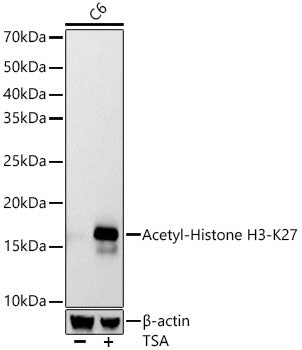 Acetyl-Histone H3-K27 Rabbit mAb