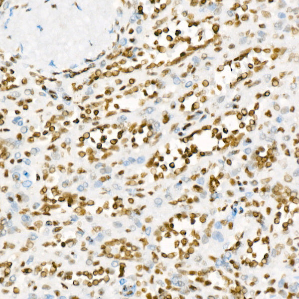 Acetyl-Histone H3-K27 Rabbit mAb