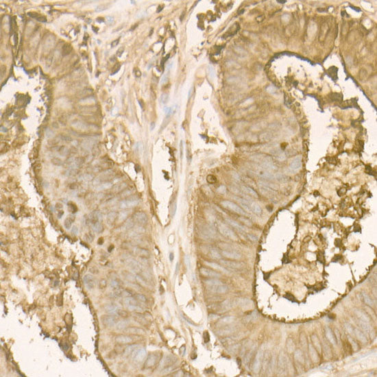 CEACAM5 Rabbit mAb