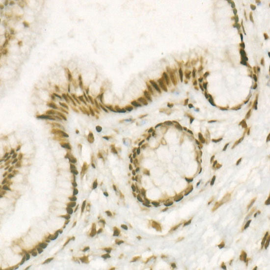 DiMethyl-Histone H4-K20 Rabbit mAb