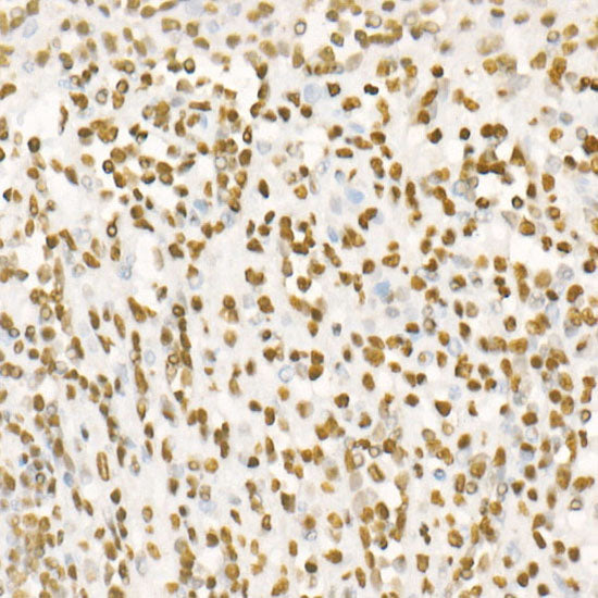 DiMethyl-Histone H4-K20 Rabbit mAb
