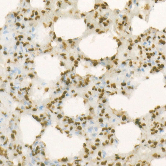 DiMethyl-Histone H4-K20 Rabbit mAb