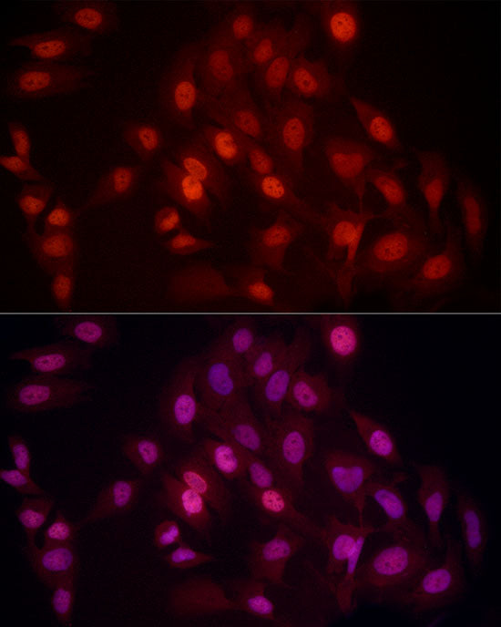 DiMethyl-Histone H4-K20 Rabbit mAb