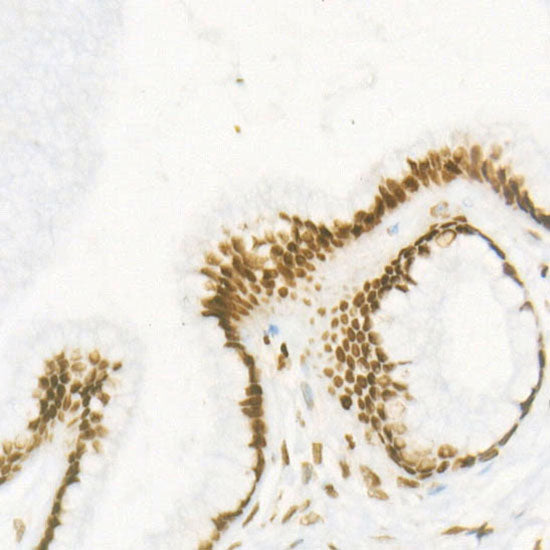 DiMethyl-Histone H4-K20 Rabbit mAb