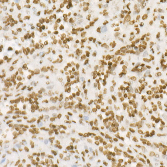 DiMethyl-Histone H4-K20 Rabbit mAb
