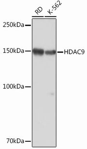 HDAC9 Rabbit mAb