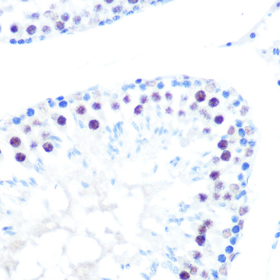 HDAC9 Rabbit mAb