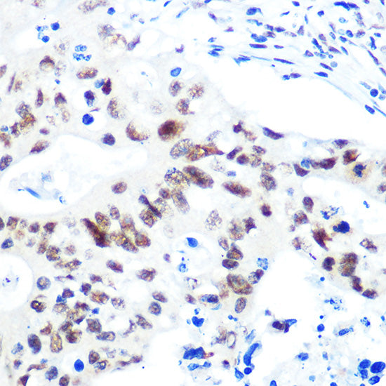 HDAC9 Rabbit mAb