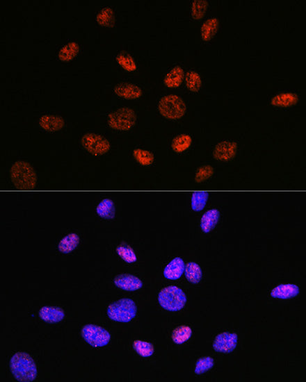 HDAC9 Rabbit mAb