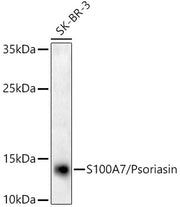 S100A7/Psoriasin Rabbit mAb