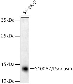 S100A7/Psoriasin Rabbit mAb