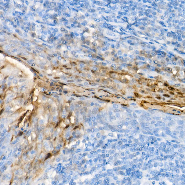 S100A7/Psoriasin Rabbit mAb