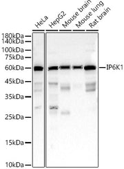 IP6K1 Rabbit mAb