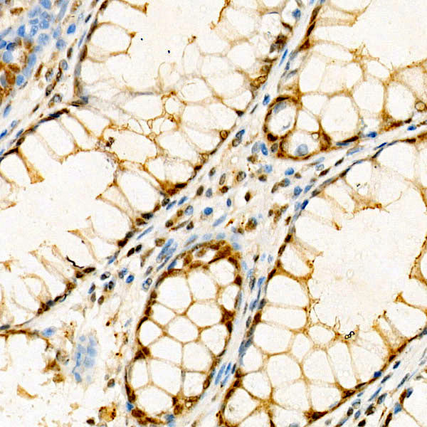 IP6K1 Rabbit mAb