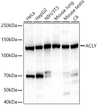 ACLY Rabbit mAb