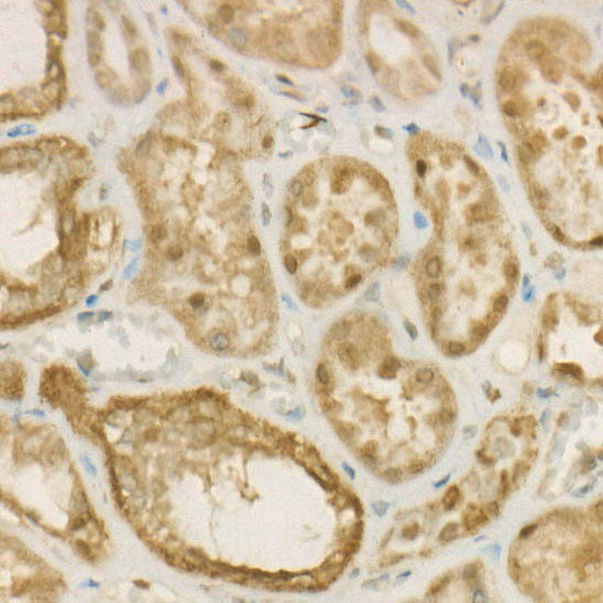 ACLY Rabbit mAb