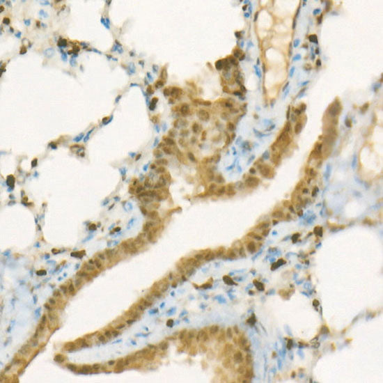 ACLY Rabbit mAb