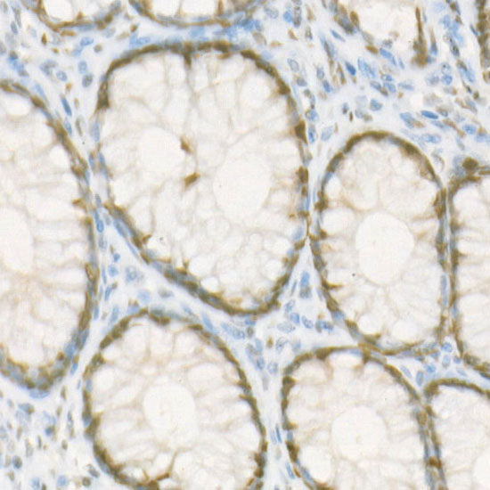 RbAp46/RBBP7 Rabbit mAb