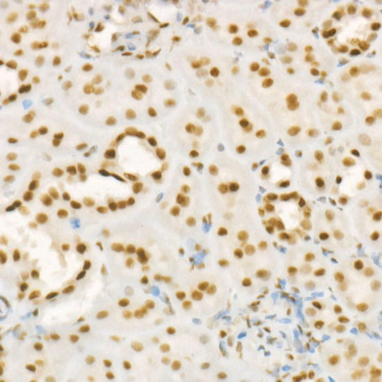RbAp46/RBBP7 Rabbit mAb