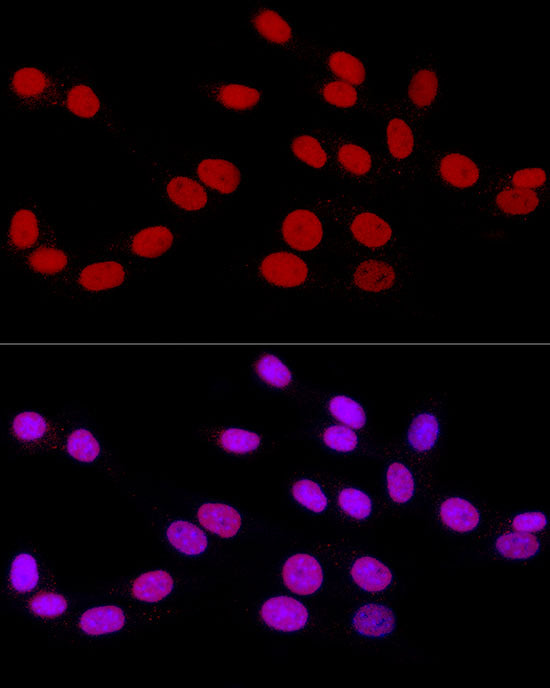 RbAp46/RBBP7 Rabbit mAb