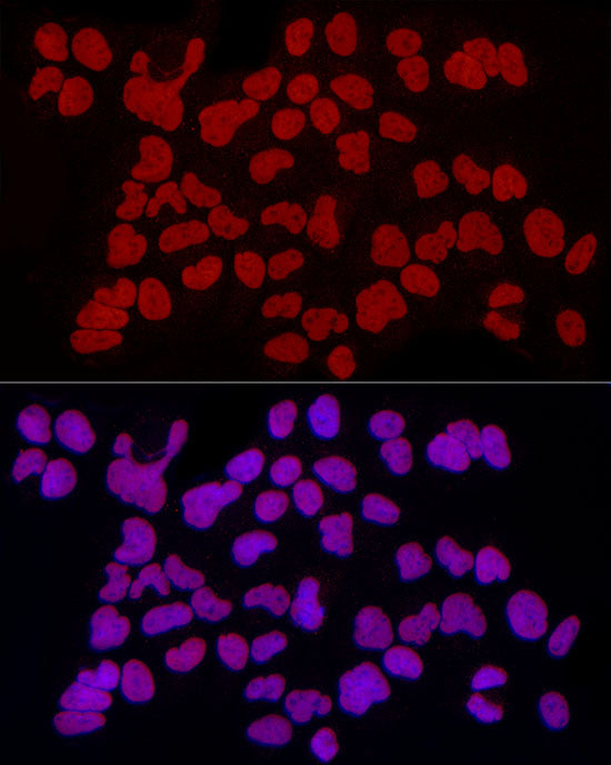 RbAp46/RBBP7 Rabbit mAb