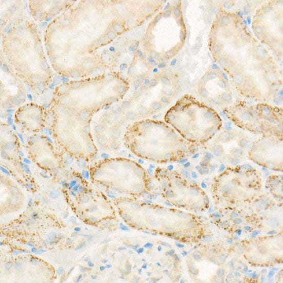 AIFM2/FSP1 Rabbit mAb