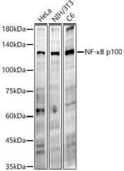 NF-κB2 Rabbit mAb