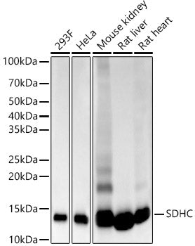 SDHC Rabbit mAb