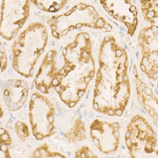 SDHC Rabbit mAb