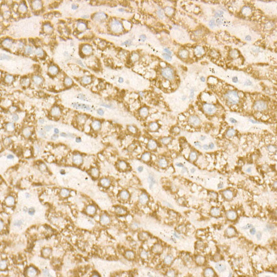 SDHC Rabbit mAb