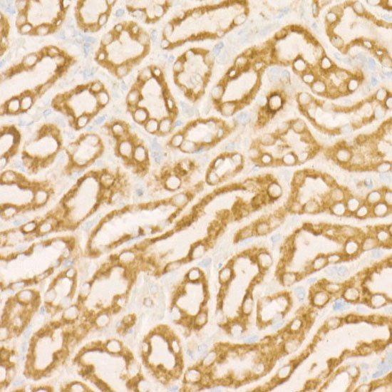 SDHC Rabbit mAb