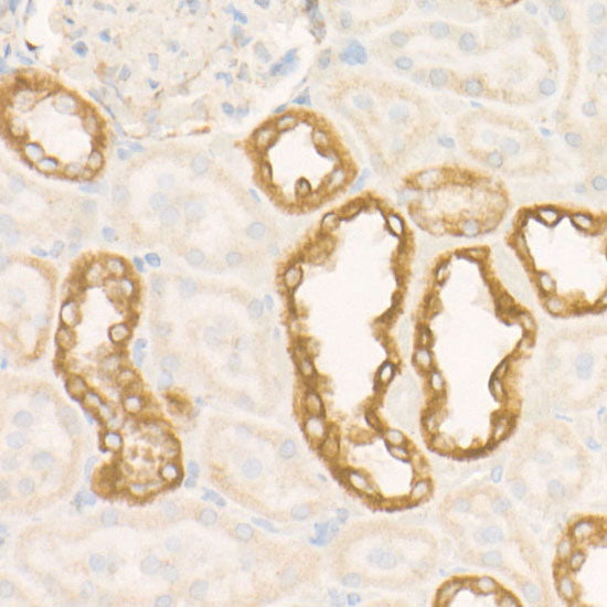 SDHC Rabbit mAb