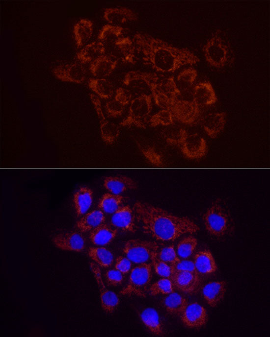 SDHC Rabbit mAb