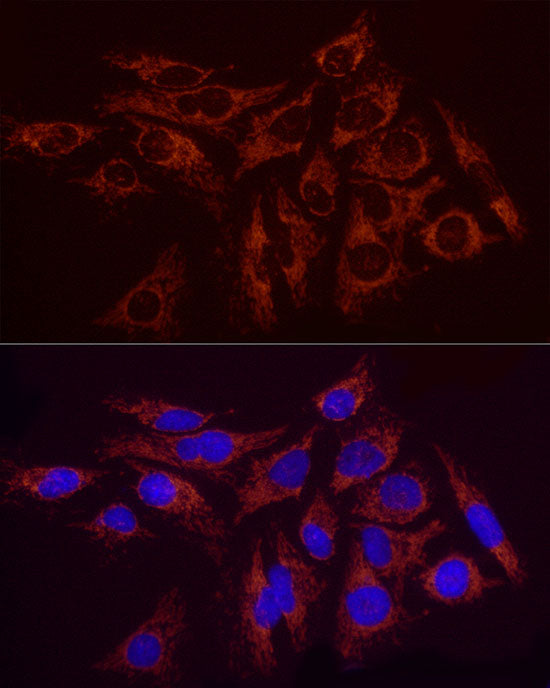 SDHC Rabbit mAb