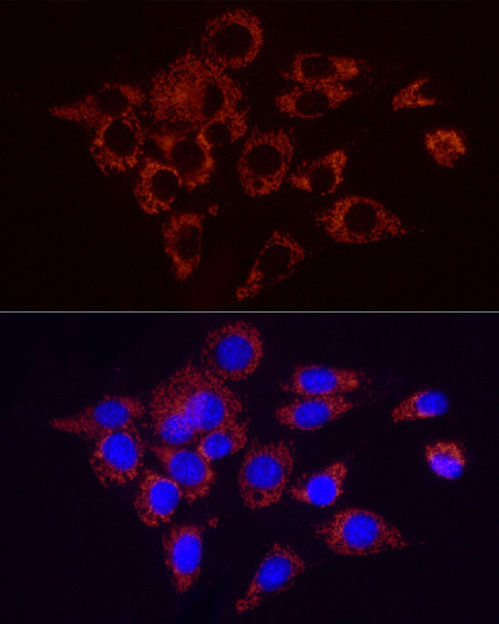 SDHC Rabbit mAb