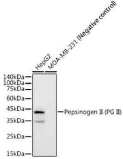 Pepsinogen II (PG II) Rabbit mAb