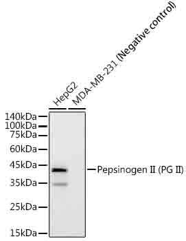 Pepsinogen II (PG II) Rabbit mAb