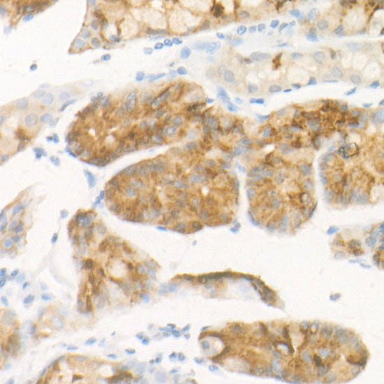 Pepsinogen II (PG II) Rabbit mAb