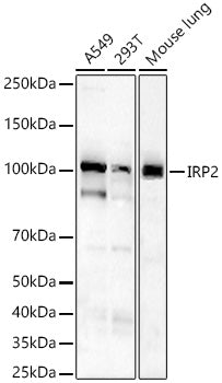 IRP2 Rabbit mAb