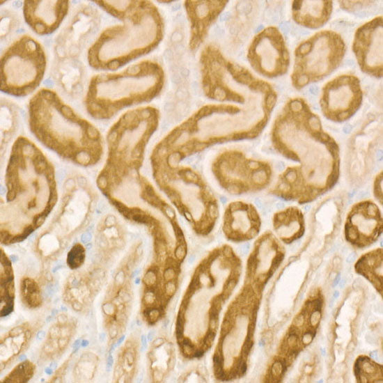 IRP2 Rabbit mAb