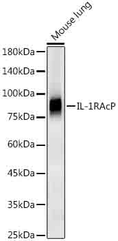 IL-1RAcP Rabbit mAb