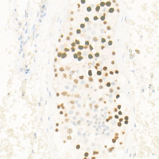 Lsh/HELLS Rabbit mAb