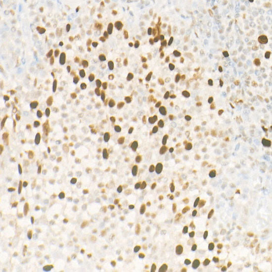 Lsh/HELLS Rabbit mAb