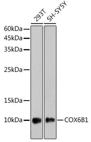 COX6B1 Rabbit mAb