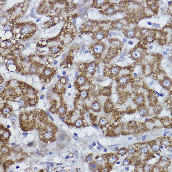COX6B1 Rabbit mAb