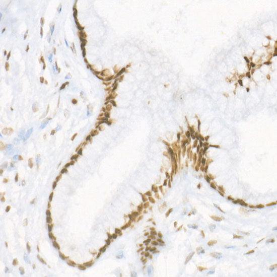 Symmetric DiMethyl-Histone H3-R17 Rabbit mAb